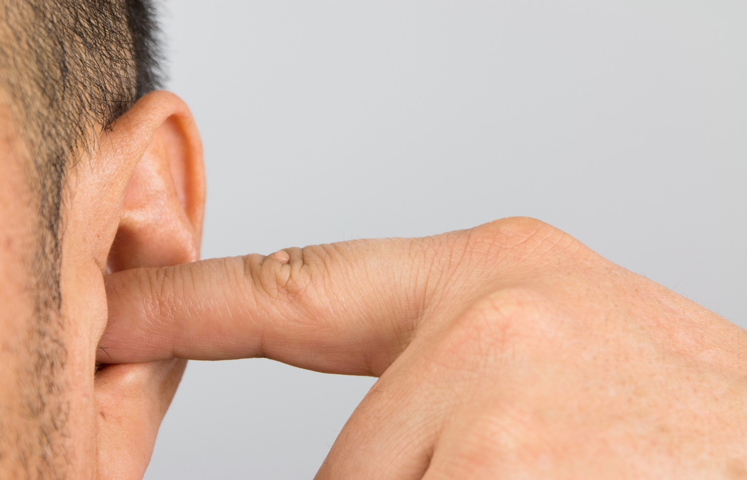 Gros plan d'une oreille évoquant l'hypoacousie et la sensation d'oreille bouchée